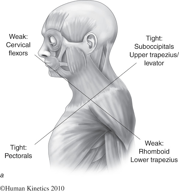 Anatomy of Neck and shoulder pain musculature